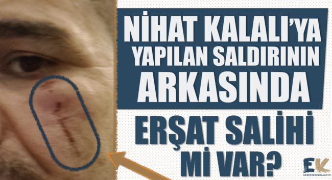 turkmen_aktivist_nihat_kalaliya_yapilan_saldirinin_arkasinda_ersat_salihi_mi_var_h48169_8276c